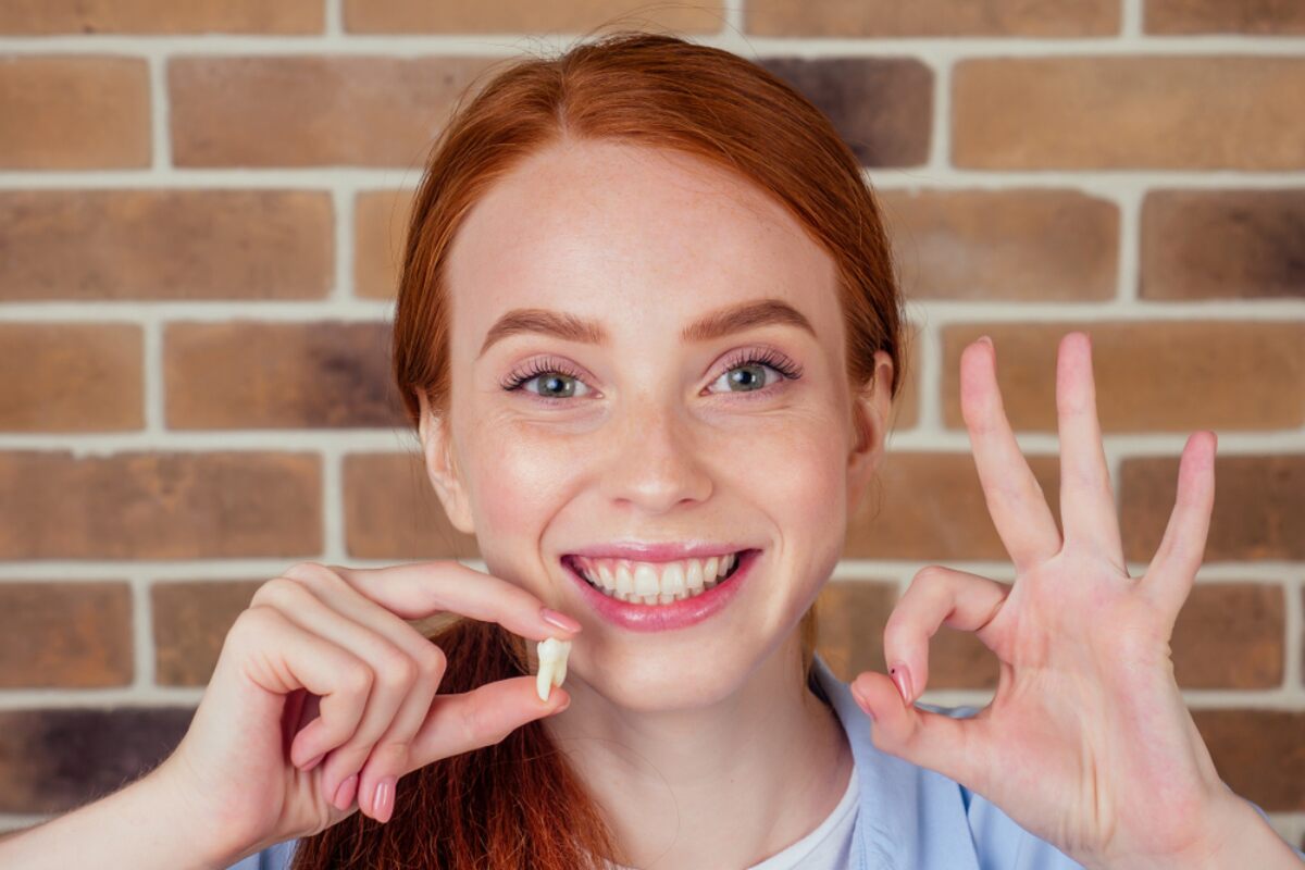 understanding wisdom teeth what you need to know